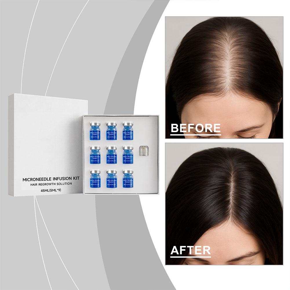 Derma Roller 0.25 - مجموعة أدوات العناية بالشعر: سيروم أساسي