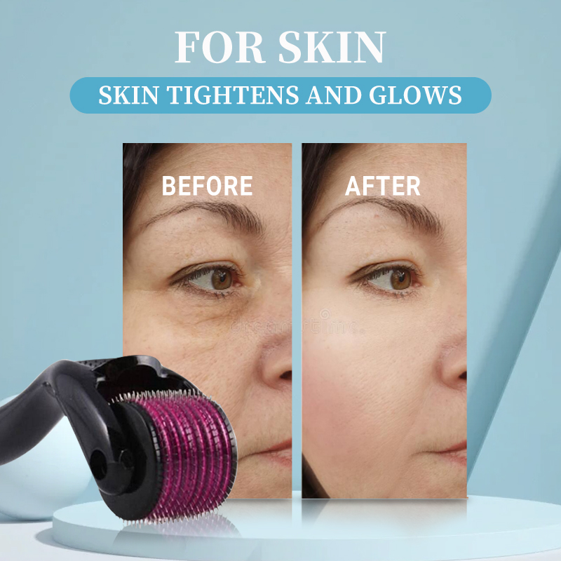 المهنية 540 الأسطوانة ديرما 0. - مراجعة Derma Roller 0.25 وسعره