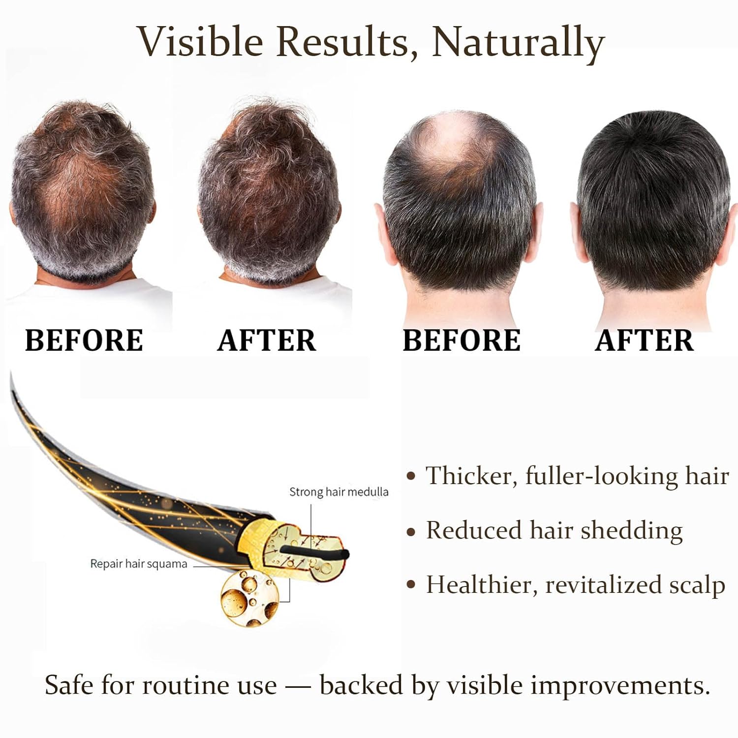 مجموعة أسطوانات الإبر الدقيقة  - مراجعة Derma Roller 0.25 وسعره